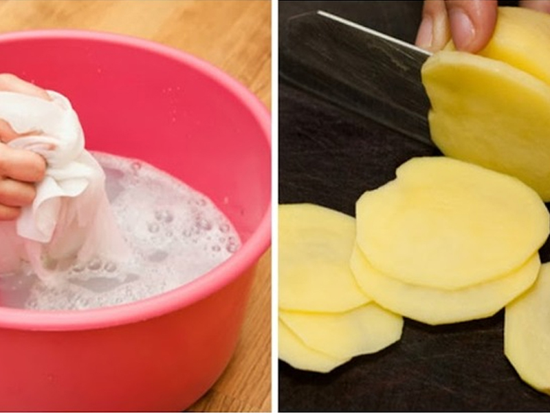 Loại bỏ vết thâm kim bằng cách sử dụng khoai tây